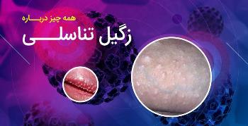 زگیل تناسلی (hpv) و علائم و عوارض آن